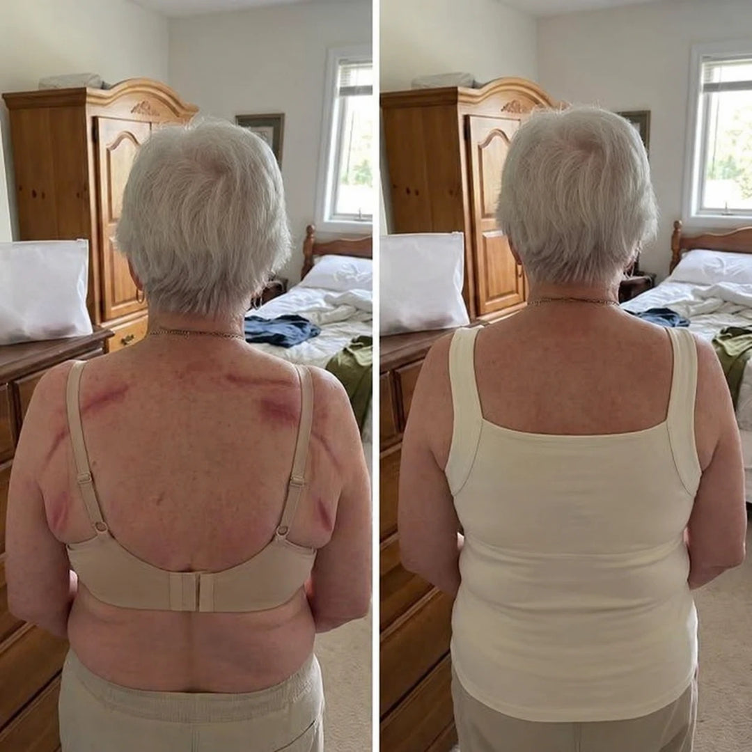Back view of the same woman in her bedroom before and after: her bra straps and band have left red marks across her shoulders and back; in a cream tank her back is smooth