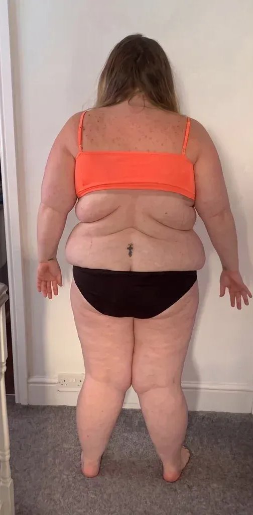 The same woman in a bandeau bra: rolls above and below the band across her back